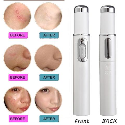 LUMISKIN™ ClearSkin Pen – Stylo Anti-Acné