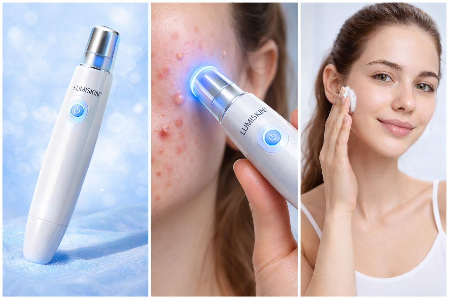 LUMISKIN™ ClearSkin Pen – Stylo Anti-Acné